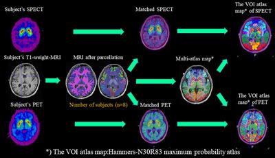 Multi-Atlas MRI-Based Striatum Segmentation for 123I-FP-CIT SPECT (DAT-SPECT) Compared With the Bolt Method and SPECT-Atlas-Based Segmentation Method Toward the Accurate Diagnosis of Parkinson's Disease/Syndrome